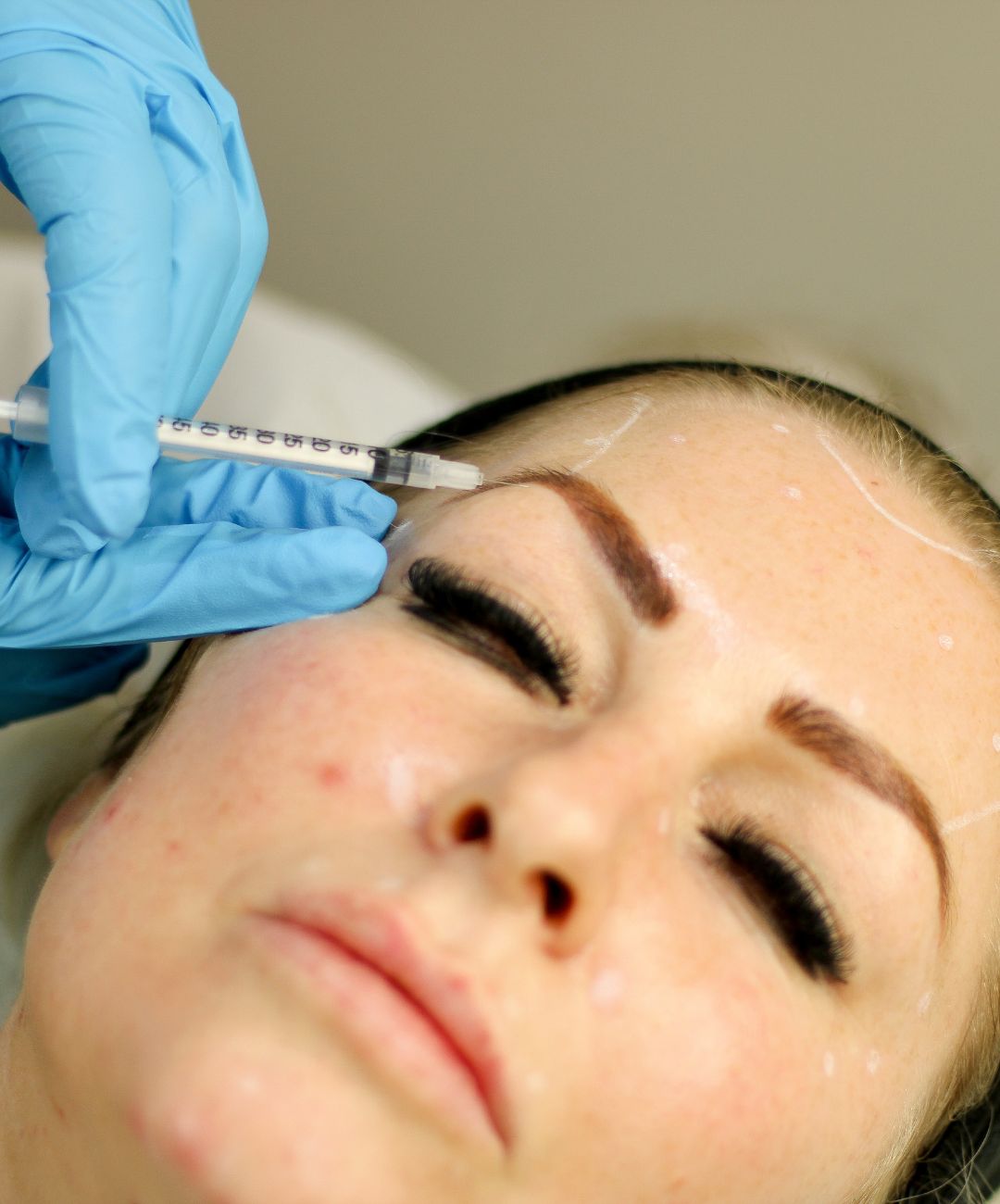 Eyebrow Lift