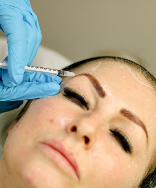 Eyebrow Lift