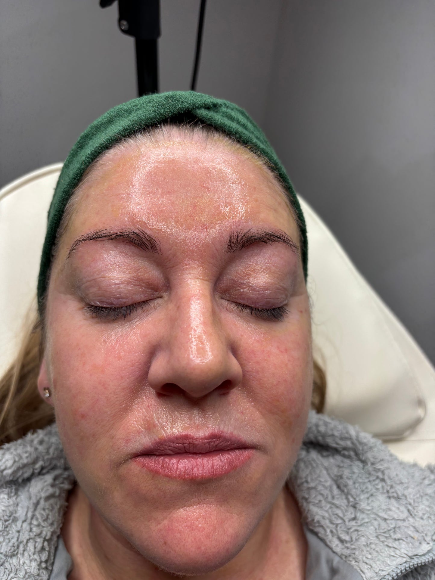 Bio Repeels C13 Face