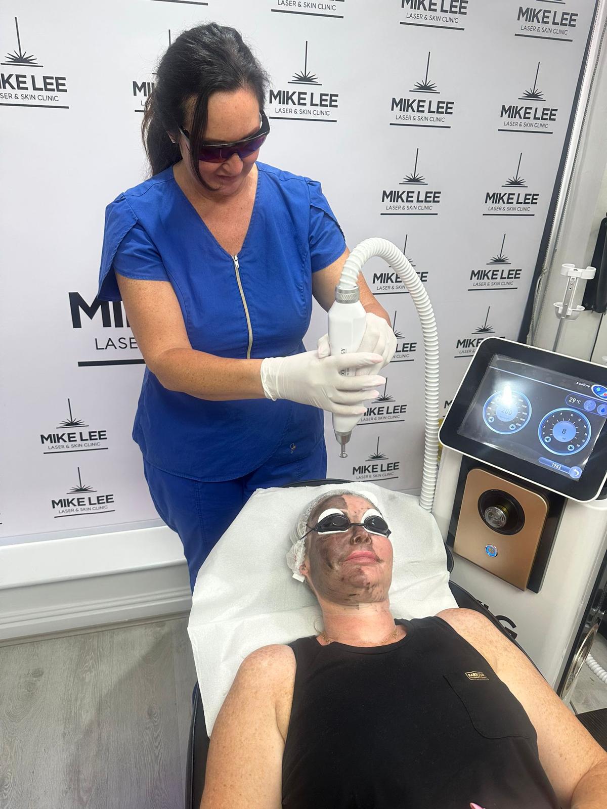 Carbon Facial (Laser)