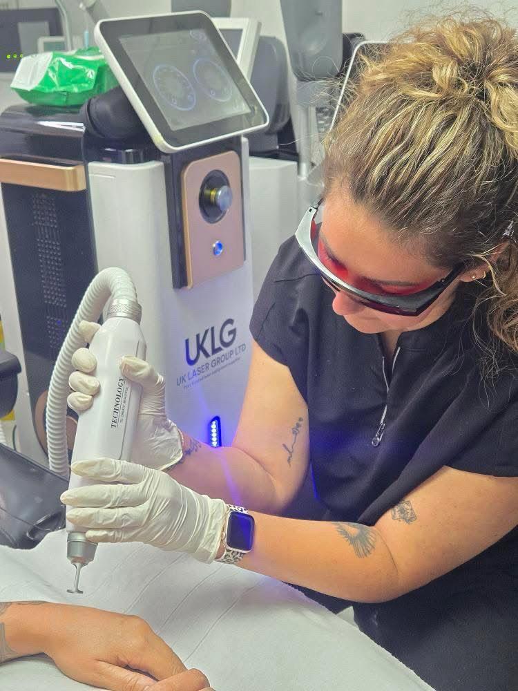 Laser Tattoo Removal