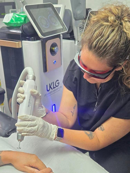 Laser Tattoo Removal