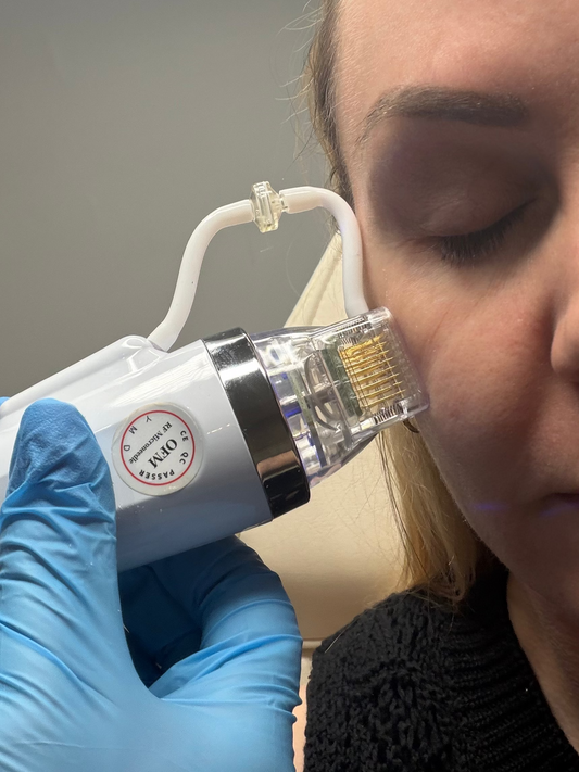 Radio Frequency Microneedling