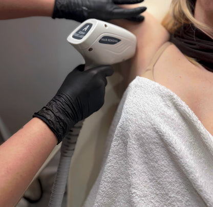 Upper Body Laser Hair Removal