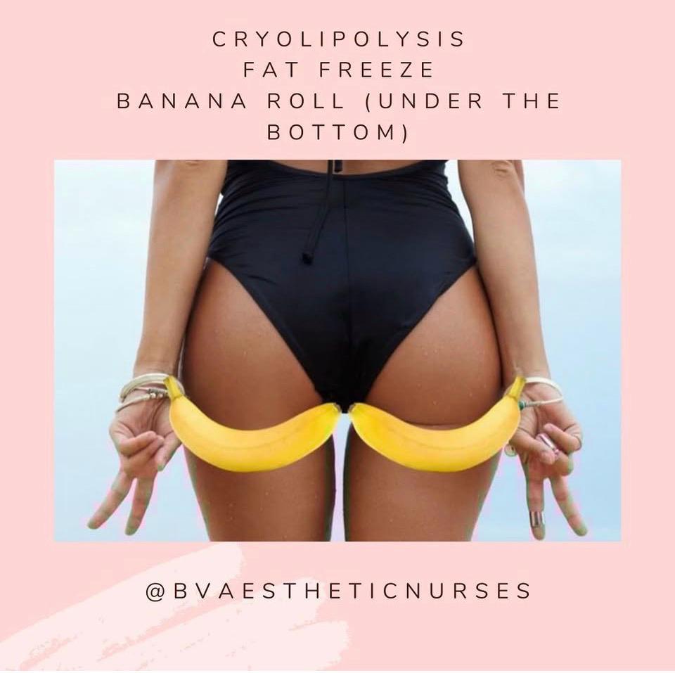 Body Sculpture Fat Freeze (Cryolipolysis)
