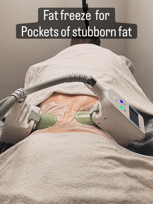 Body Sculpture Fat Freeze (Cryolipolysis)