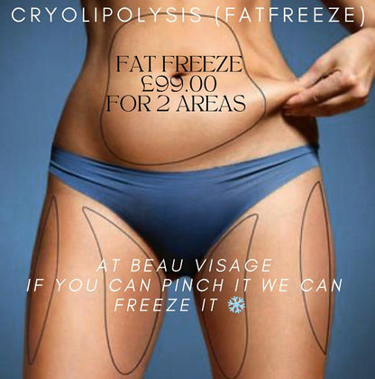 Body Sculpture Fat Freeze (Cryolipolysis)