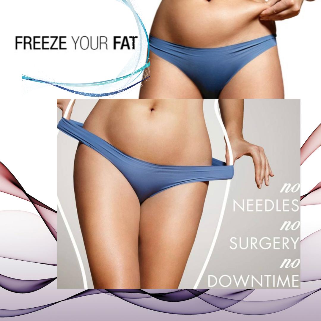 Body Sculpture Fat Freeze (Cryolipolysis)