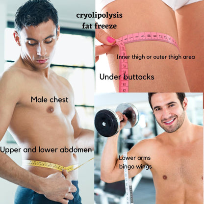 Body Sculpture Fat Freeze (Cryolipolysis)